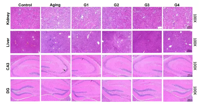 자연 노화 모델의 합성 결과 자연 노화 모델의 복합 결과