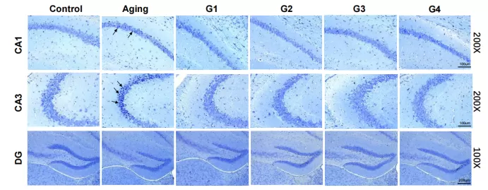 Compelling Results in the Natural Aging Model Compelling Results in the Natural Aging Model