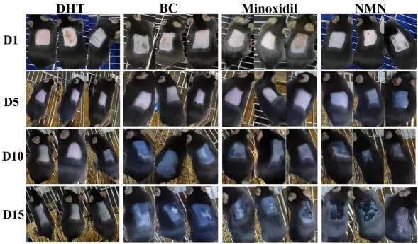 NMN 및 모발 성장: 안드로genetic 탈모증 (AGA) 의 새로운 증거
